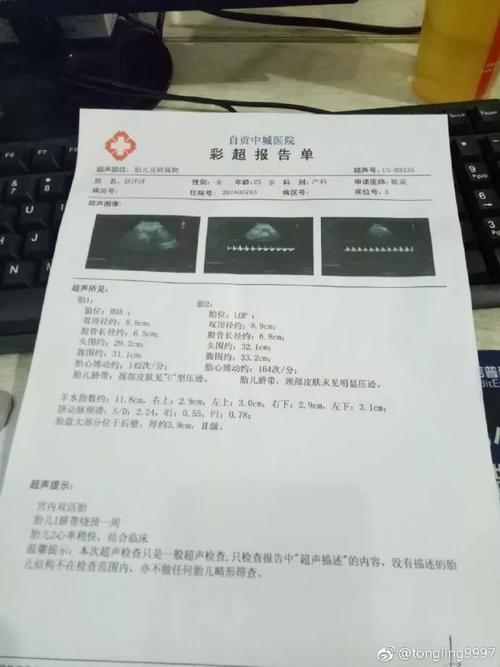 问一下双胞胎上医院检查的产检本多少钱?双胞胎旅游怎么收费-图1 问一下双胞胎上医院检查的产检本多少钱?双胞胎旅游怎么收费-图1