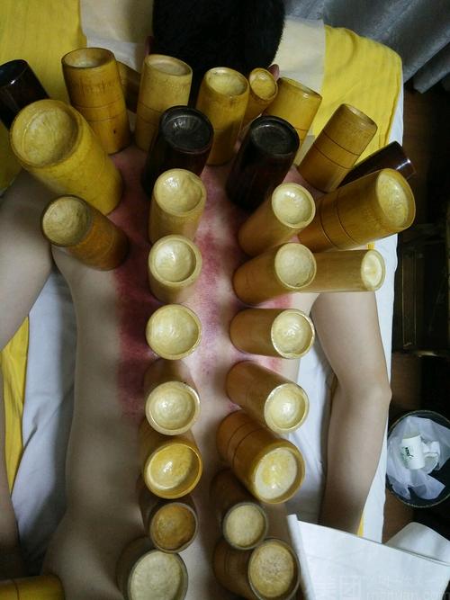 拔罐去哪里比较专业?长沙专业按摩收费标准-图3 拔罐去哪里比较专业?长沙专业按摩收费标准-图3