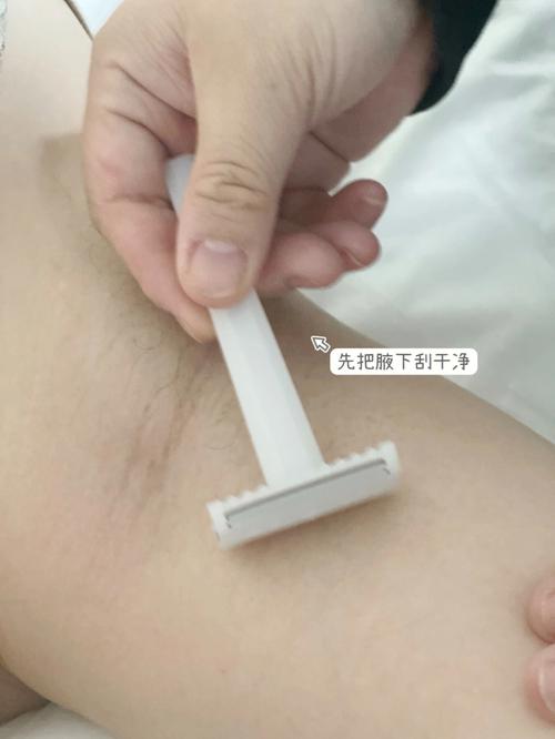 12月零下正常吗?郑州冰点脱毛怎么收费-图3 12月零下正常吗?郑州冰点脱毛怎么收费-图3