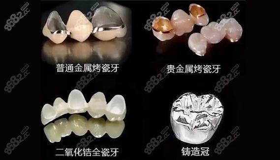 邯郸的亲人们,谁做过烤瓷牙,告诉我哪里做的?效果如何?有什么建议的?邯郸口腔医院收费标准-图3 邯郸的亲人们,谁做过烤瓷牙,告诉我哪里做的?效果如何?有什么建议的?邯郸口腔医院收费标准-图3